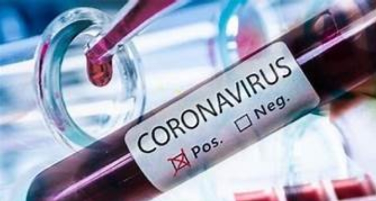Três Lagoas registra nesta terça-feira mais 27 casos confirmados de Covid