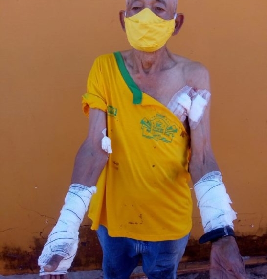 PM de folga salva três pessoas que eram atacadas por pit bull em Luiziânia
