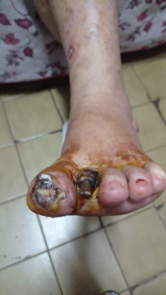 Em Andradina filha desesperada pede ajuda para mãe realizar cirurgia