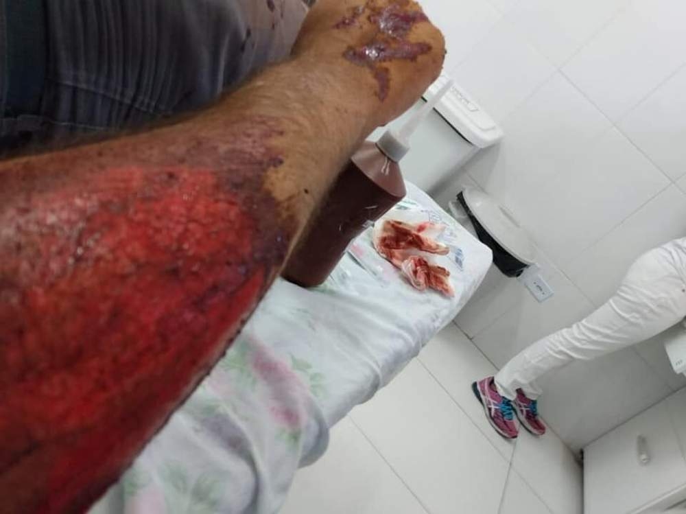 PM é atropelado em tentativa de abordagem a carro em Bilac