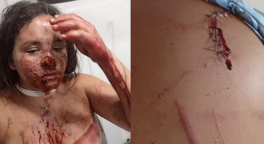 Polícia Civil de Nova Independência investiga 02 tentativas de homicídio na Praça durante virada do ano