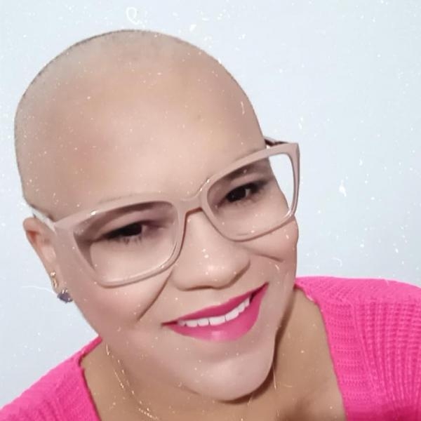 Três-lagoense, posta foto careca e encanta internautas; Conheça Thaynara Pereira Teixeira