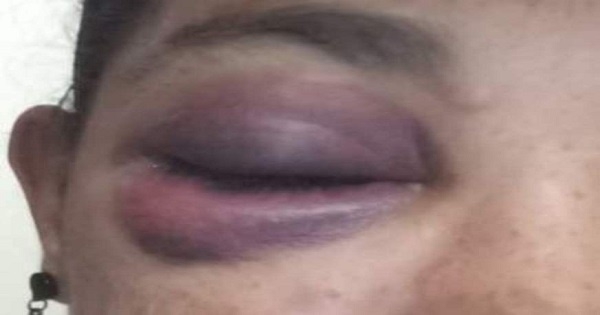 Embriagado, homem agride a ex com soco na cara e a ameaça de morte em Água Clara