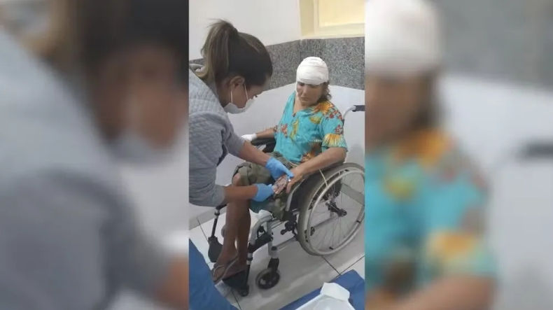 Polícia Civil de Pereira Barreto investiga idosa sofre ferimentos após ser atacada por pitbull