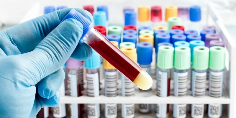 Coletas de exames laboratoriais serão realizadas na zona rural de Andradina
