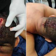 REBELIÃO, AGRESSÃO E FUGA NO CR BIRIGUI