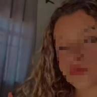 Estado é grave da jovem de Andradina que teve 80% do corpo queimado ao fumar narguillé