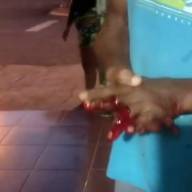 Discussão termina com homem gravemente ferido no bairro Laranjeiras em Castilho