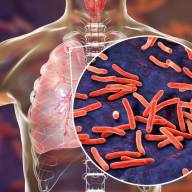 Prefeitura de Três Lagoas reforça conscientização no Dia Mundial da Tuberculose