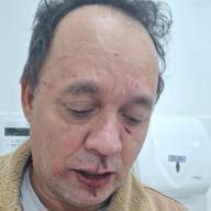 Discussão entre o prefeito de Nova Independência (SP) e médico de hospital particular de Andradina (SP) termina em violência 