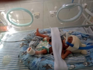 Santa Casa de Araçatuba realizou Semana da Prematuridade